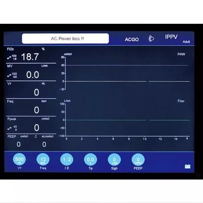 Taşınabilir Maquina De Anestezi 10.4 İnç LCD Ekran Anestezi Makinesi