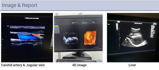 2D 3D 4D Ekokardiyografi Kardiyak Arabası Yankı Renkli Doppler Ultrason Makinesi