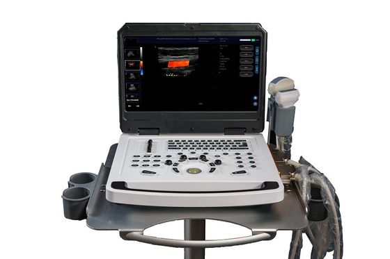 CE Portatif Renkli Doppler Ultrason Makine Tarayıcısı OEM